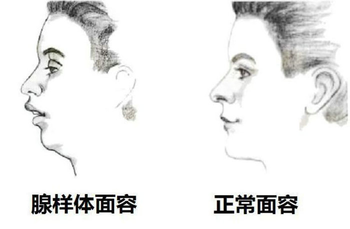 苏报集团（引力播）：7岁女娃越长越“傻” 真实原因出人意料 (1).jpg