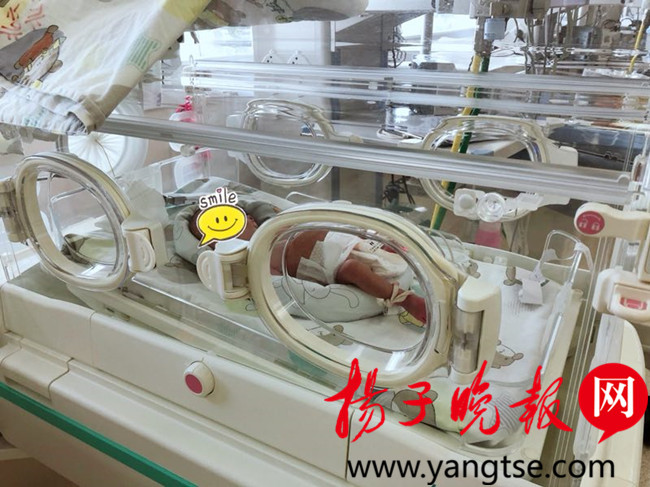 扬子晚报（扬眼）：苏州2斤多宝宝出生，孕妈头昏眼花可得当心.jpg