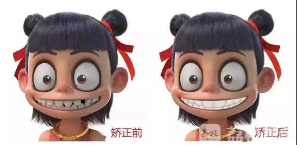 荔枝网：我牙由我不由天？”苏州医生巧用“丑哪吒”做“牙齿”科普 (5).jpg