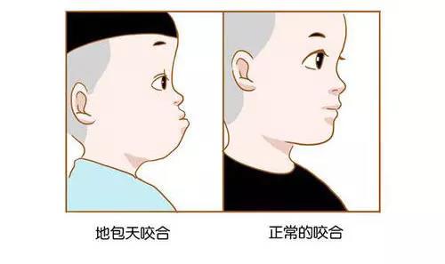 看苏州：“我牙由我，不由天”！你家“小哪吒”也有这些问题吗？-3.jpg