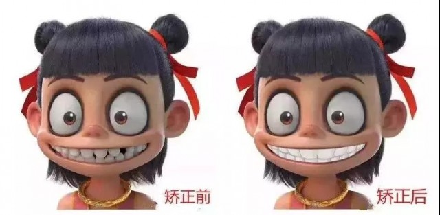 看苏州：“我牙由我，不由天”！你家“小哪吒”也有这些问题吗？-6.jpg