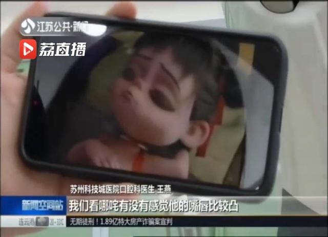 江苏新闻：“我牙由我不由天？”苏州一医生巧用“丑哪吒”做“牙齿”科普-2.jpg
