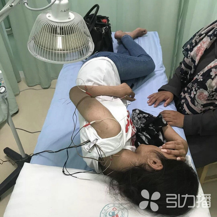 苏报集团（引力播）：自幼“左手缺席”，英国姑娘在苏州重燃康复希望-2.jpg