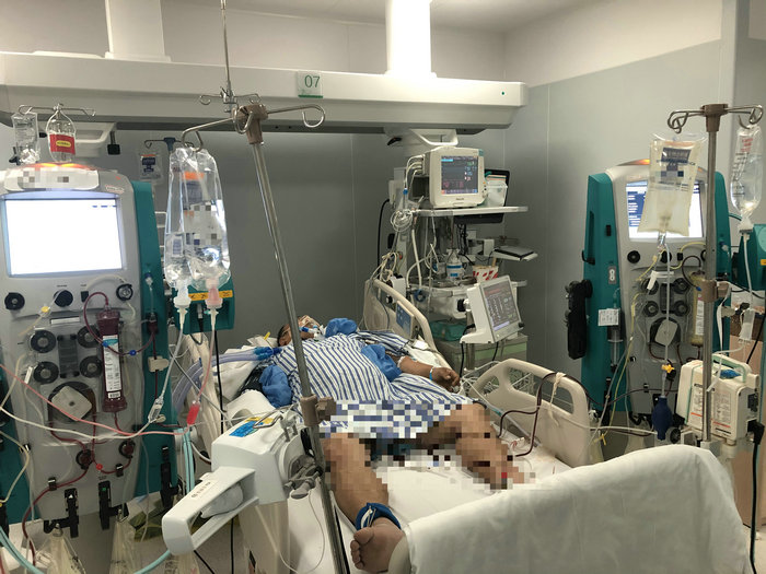 血脂超出正常16倍！年轻男子突发急性胰腺炎入院 (2).jpg