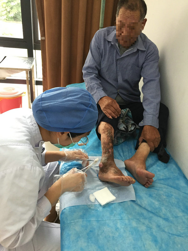优质护理资源下沉 我院延续护理温暖人心.jpg
