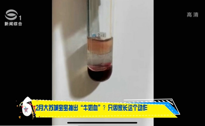 2月龄宝宝被抽出牛奶血 竟是家长这个错误习惯 (3).jpg
