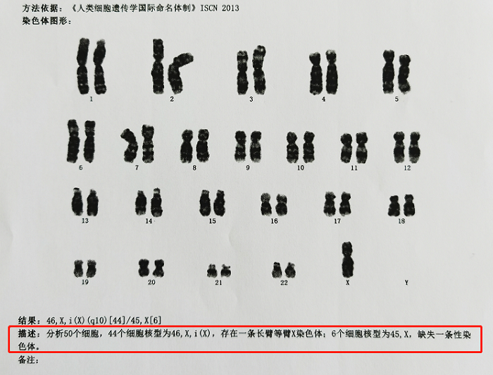 花季少女个子矮小，竟是这个少见病.png