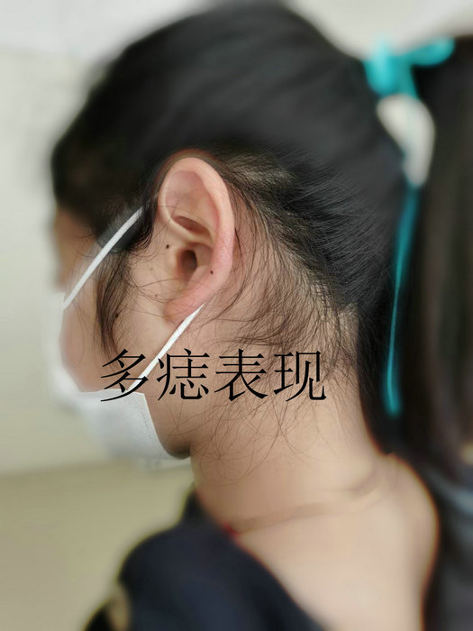 花季少女个子矮小，竟是这个少见病.jpg