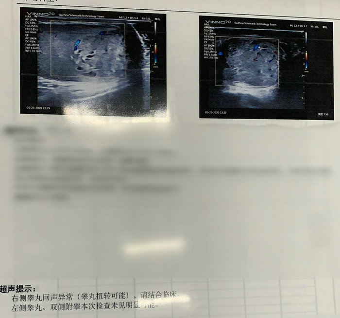 小伙睾丸扭转险切除！“蛋疼”不能忍，青少年高发.jpg