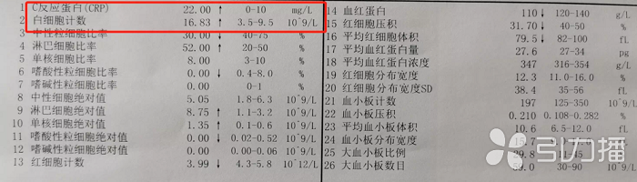 苏报集团（引力播）：苏城4岁娃高烧不退 竟是感染了“亲吻病毒”2.png