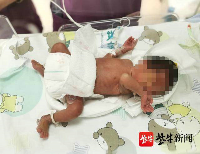 扬子晚报（紫牛新闻）：精心呵护 26周早产儿回归妈妈怀抱2.jpg