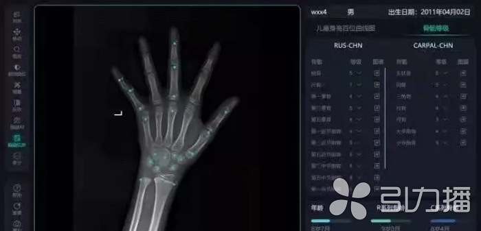 苏报集团（引力播）：人工智能免费测骨龄！苏州这家医院明天有义诊2.png