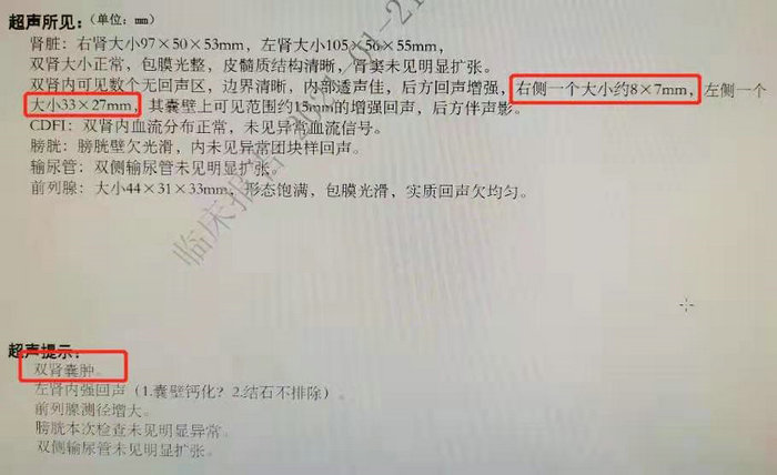 腰背部酸胀原来是肾脏出了问题 专家提醒这些注意事项 (2).jpg