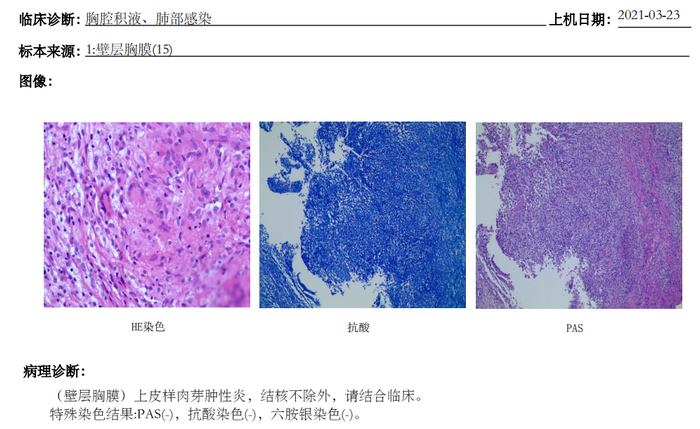 我院开展内科胸腔镜，助力胸膜疾病精准诊治.PNG