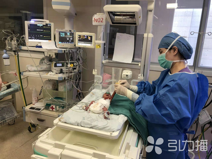 苏报集团（引力播）：留置针置入发丝粗细的血管，为“袖珍宝宝”开启生命新通道2.jpg
