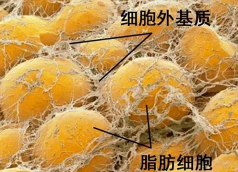 南大苏州医院SVF技术，让渐冻症、多系统萎缩患者看到希望.png