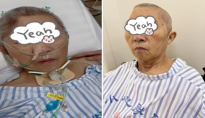 “早拔管、早康复” 南大苏州医院多学科协作点亮患者重生路.png “早拔管、早康复” 南大苏州医院多学科协作点亮患者重生路.png