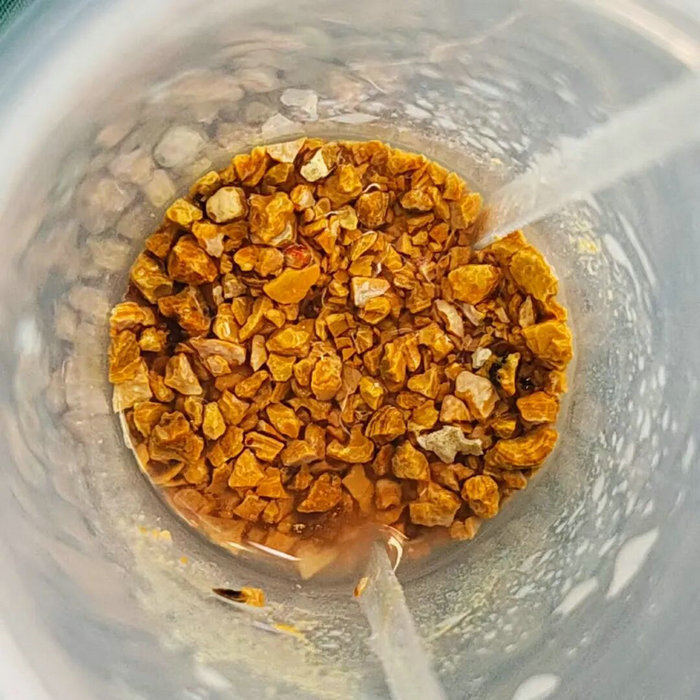 泌尿结石不用慌 我院开展术中结石分析技术精准诊疗